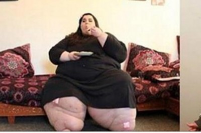 Jak ważyła 300 kg przeszła operacje zmniejszenia żołądka! Po roku lekarze nie mogli jej poznać!