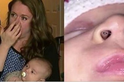 Karmiła piersią dziecko, kiedy zauważyła w jego nosie czarne punkciki. Po chwili połączyła fakty