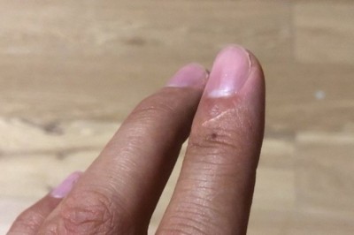 6 osobliwych cech i znaków szczególnych, które posiada 99% ludzi. Zobacz czy jesteś wyjątkiem