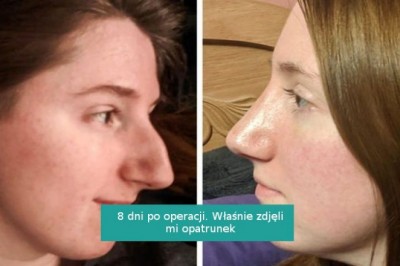 Zdjęcia przed i po, pokazujące, że mała zmiana potrafi zrobić ogromną różnicę
