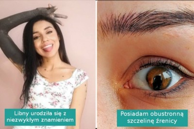 15 zdjęć pokazujących, że piękno nie wymaga wcale perfekcji ani ideału