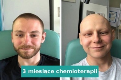 14 zdjęć „przed i po”, które sprawią, że ze zdumienia przetrzesz oczy