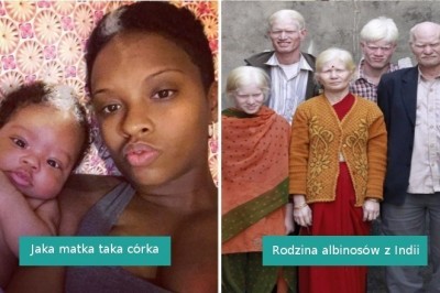 Ci ludzie wygrali na loterii genetycznej i zaskakują swoim wyglądem