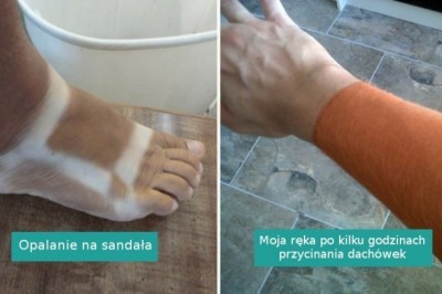 17 osób, które przypadkowo przesadziły ze swoją opalenizną