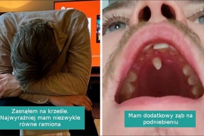 17 fotografii unikalnych osób, które pokazują, że geny potrafią być nieprzewidywalne