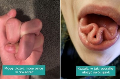 18 fotografii pokazujących, jak zdumiewające potrafi być ludzkie ciało