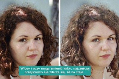 8 zmian zachodzących w ciele kobiety po urodzeniu dziecka. Nie każda jest pozytywna