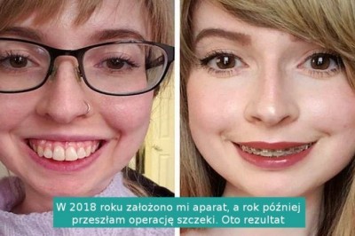 18 osób, których uśmiech opłacony został dużym wysiłkiem i wyrzeczeniami